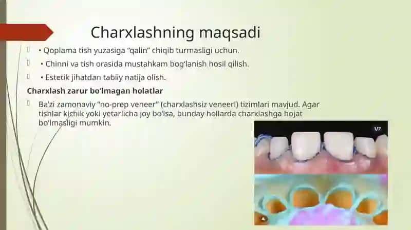 Chinni qoplamalar uchun tishni charxlash.Chinni qavatlarini surish qoidalari.Press keramikadan qoplamani tayyorlash labarator bosqichlarini xususiyati.Dioksid sirkon qoplamalarini tayyorlash 2