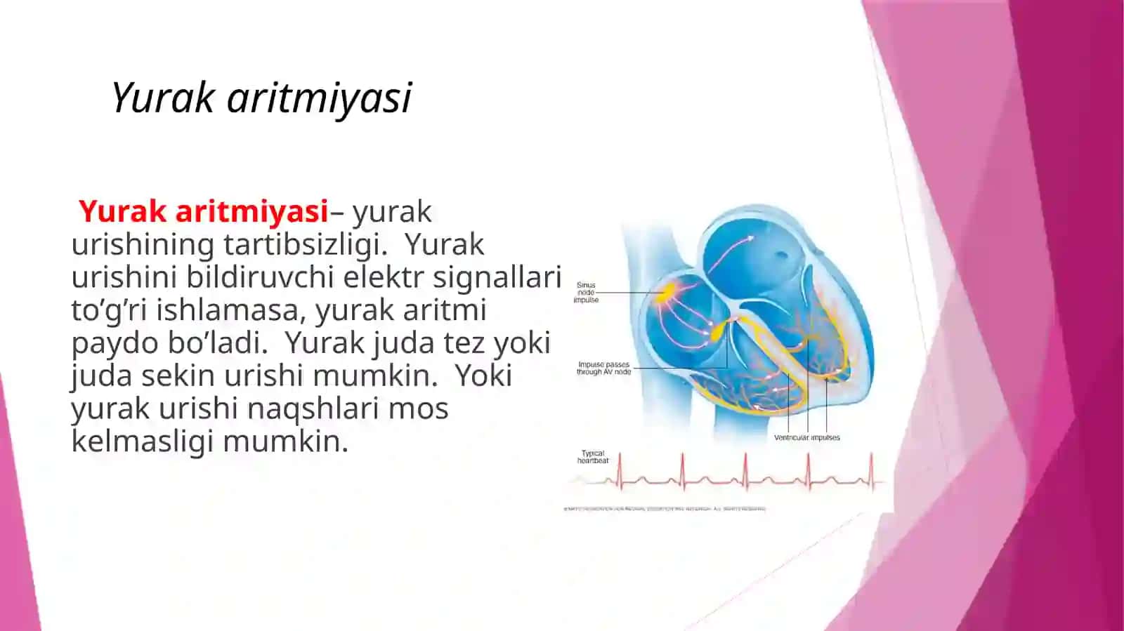 YurakaritmiyalariEKG diagnostikasi 2