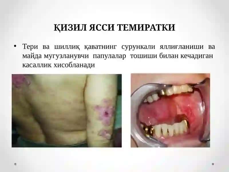 Қизил Ясси Темиратки 2
