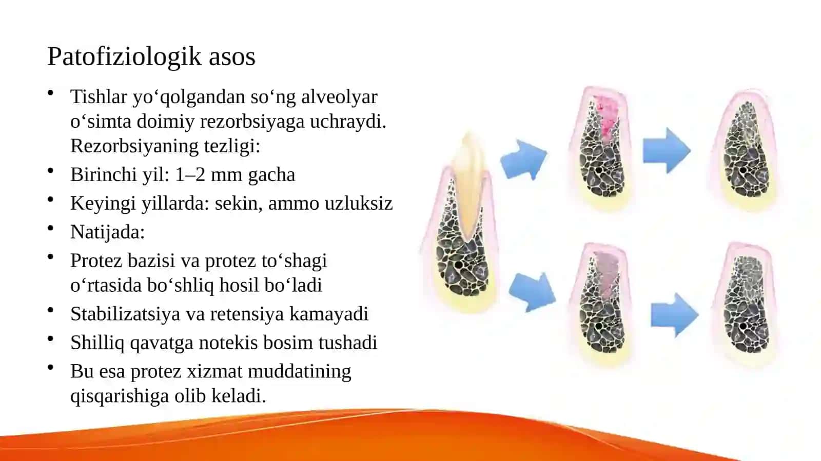Tish shifokori tomonidan to’liq olinadigan tish protezlari ishlash muddatini uzaytirish usullarining 2