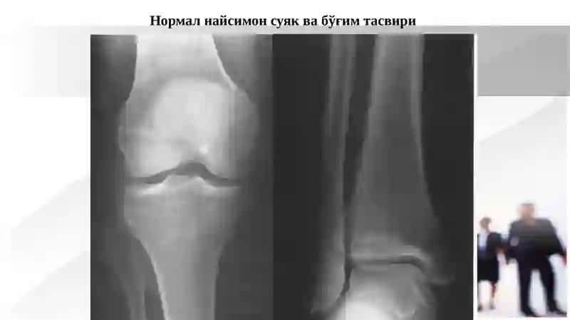 Суякларнинг тараққий этиши, тузилиши ва рентгеноанатомияси 2