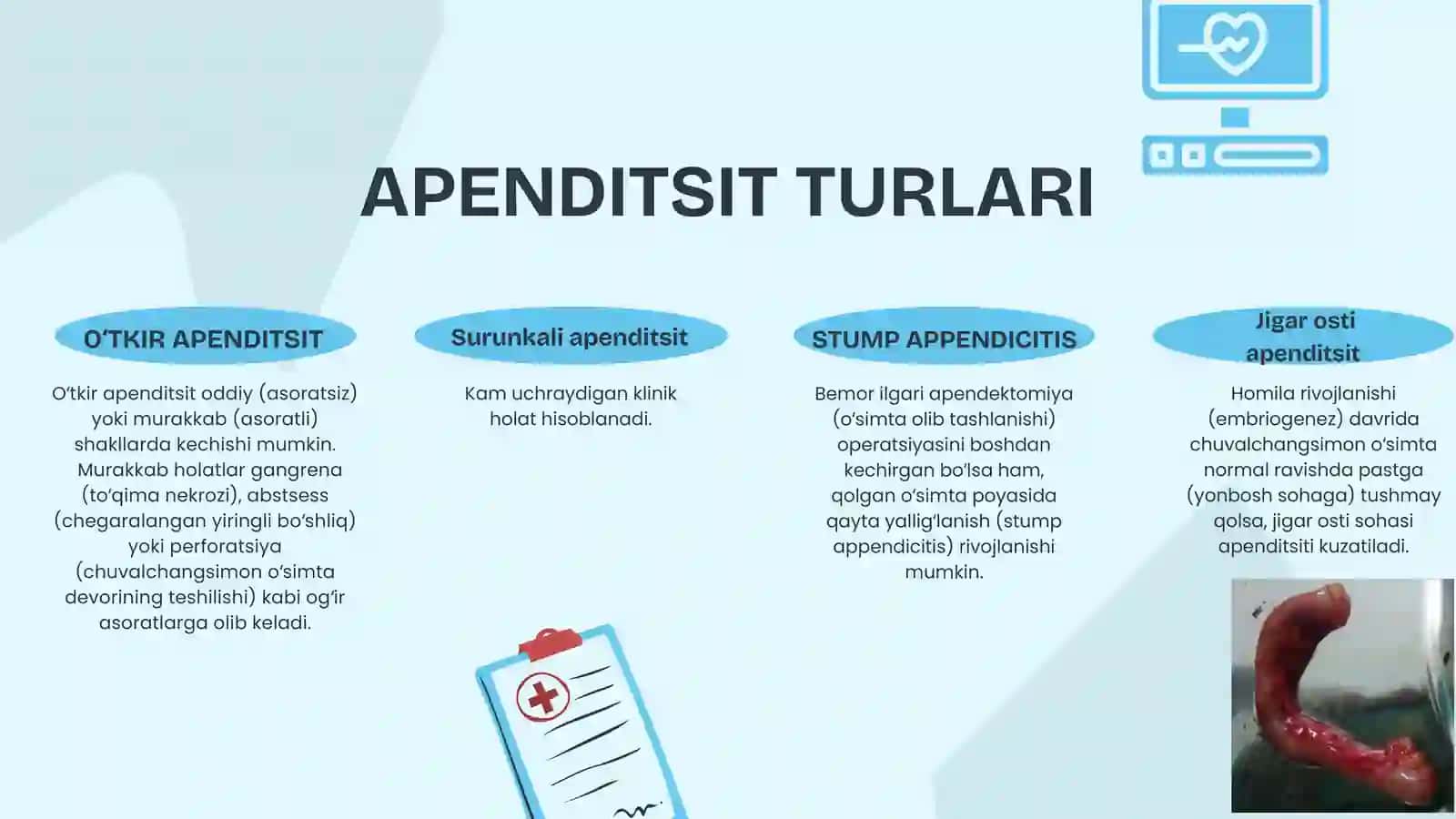 Appenditsit nur tashxis usullari. 2