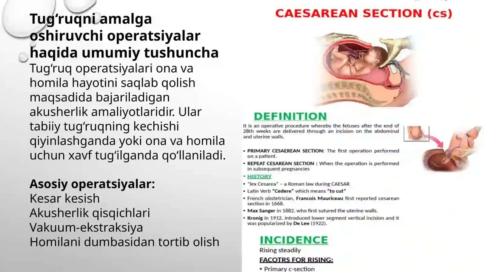 Tugʻruqni amalga oshiruvchi operatsiyalar | Kesar kesish, akusherlik qisqichlari, vakuum-ekstraksiya 2
