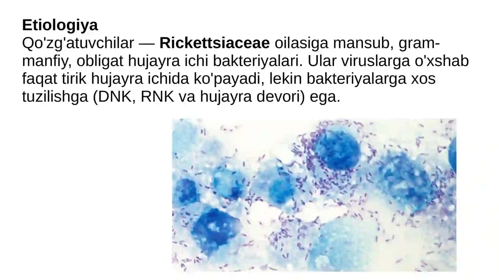 Rikketsiozlar 2
