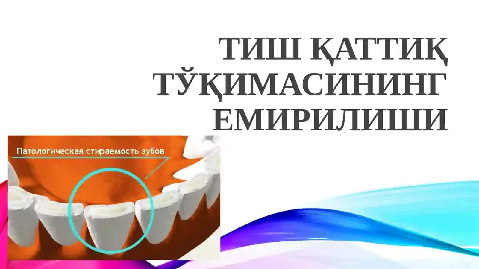Tish chiqqandan keyin paydo bóladigan nokariyes kasalliklar. Tish qattiq tóqimasi nekrozi 2