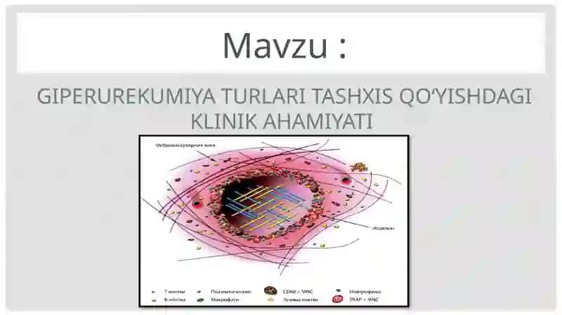 Giperurikemiya turlari 2