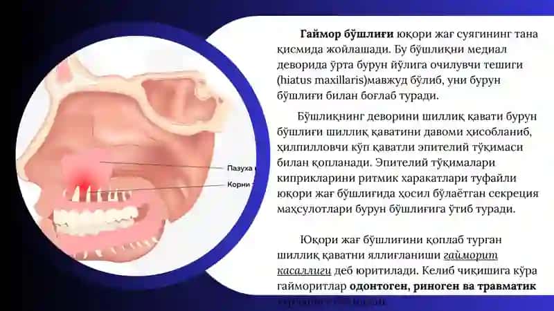 ODONTOGEN GAYMORIT 2