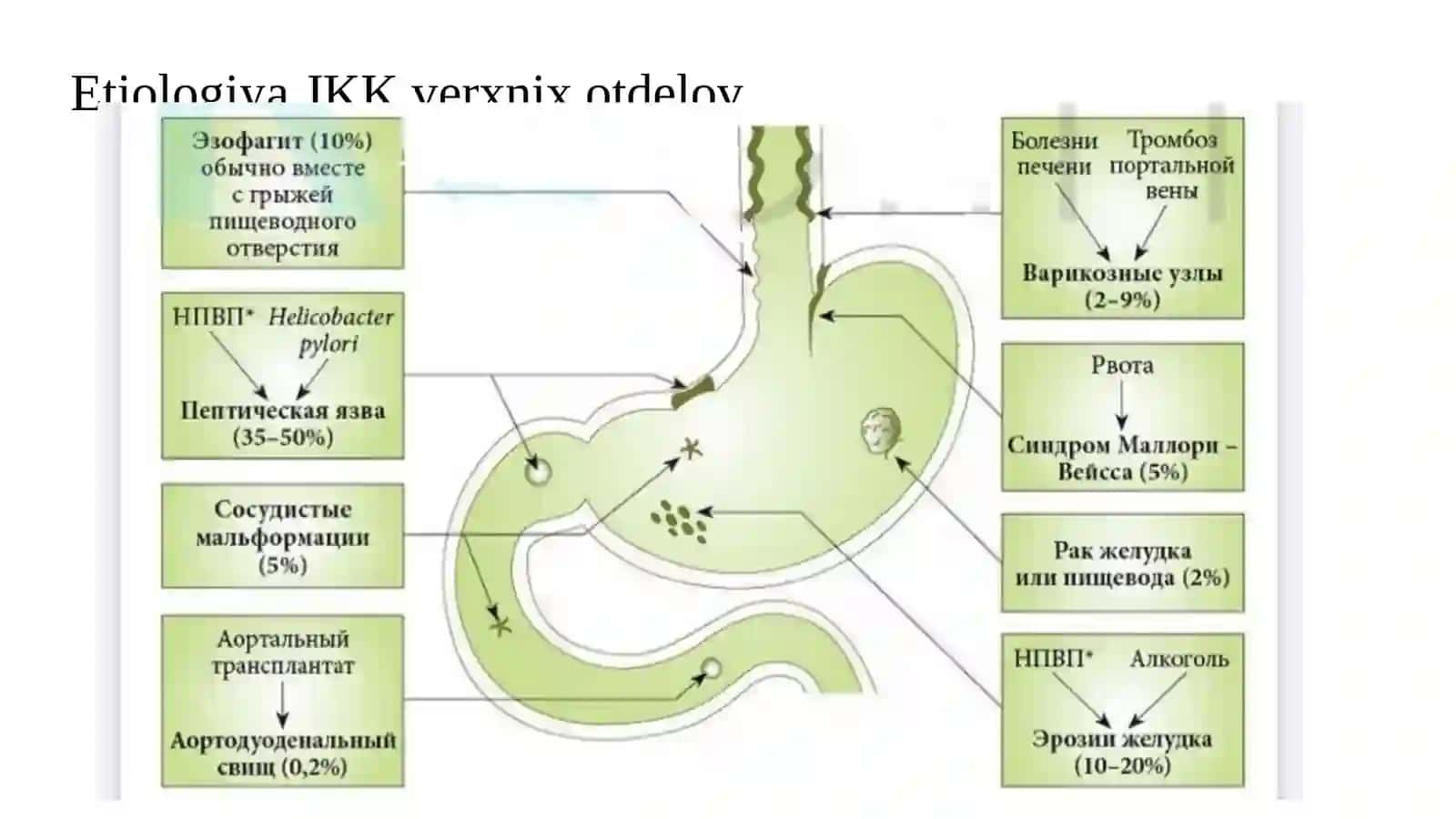 Oshqozon-ichak qon ketishlarini zamonaviy endoskopik davolash 2