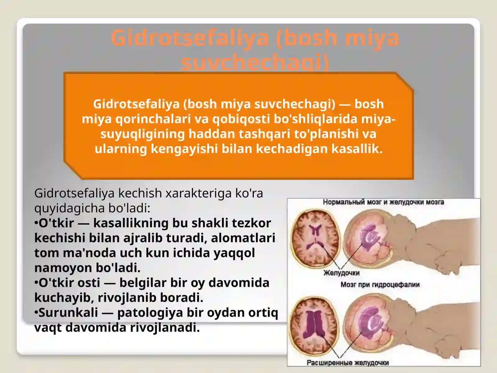 Gidrosefaliya (bosh miya istisqosi) diagnostikasi va klinikasi 2