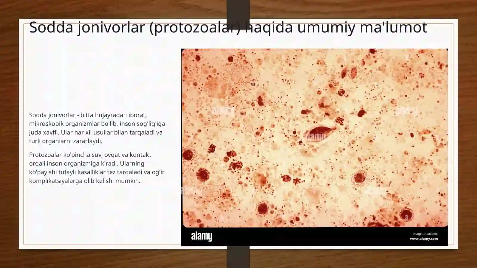 Sodda jonivorlar keltirib chiqaruvchi kasalliklar va ularning laboratoriya diagnostikasi 2