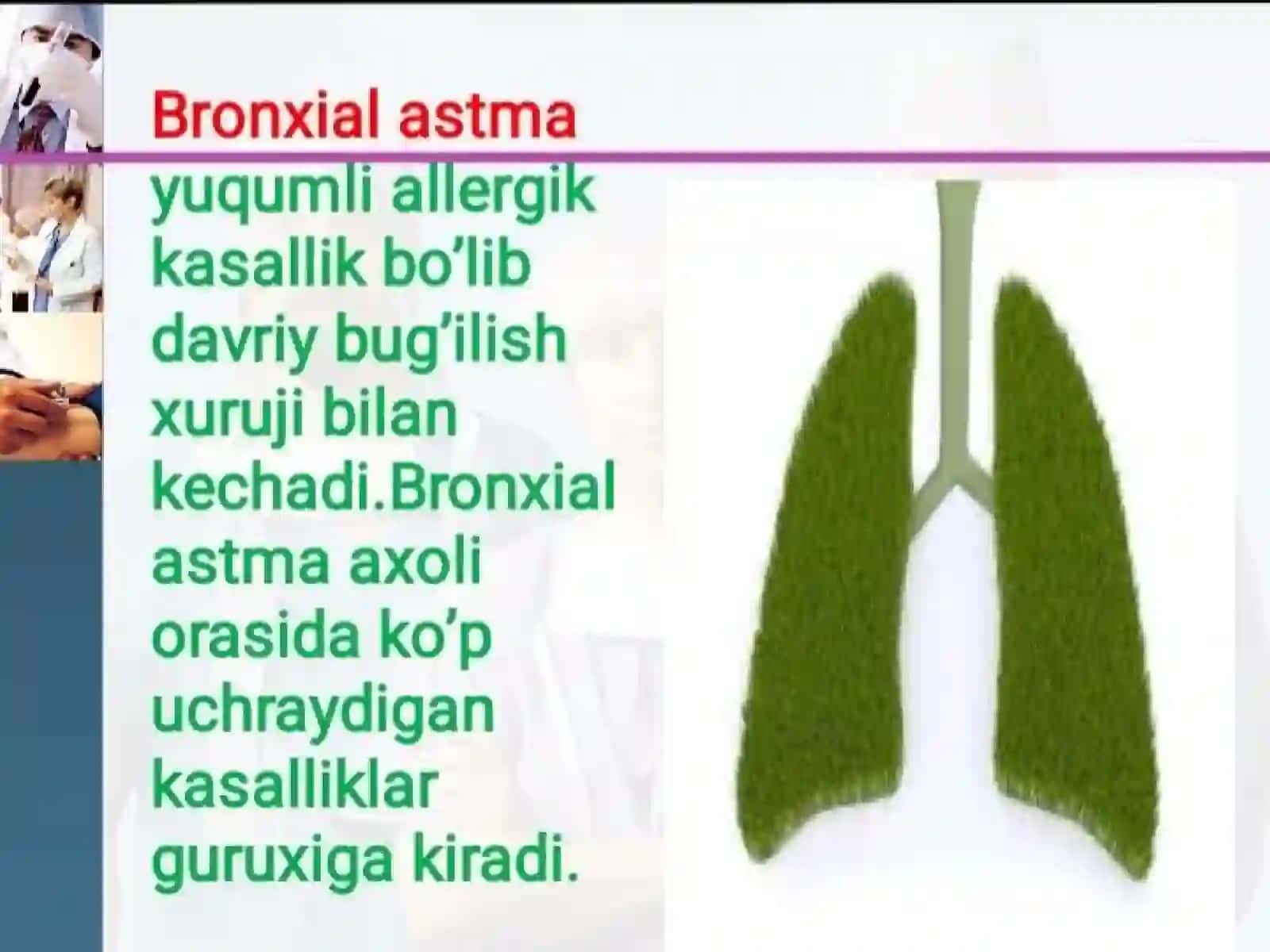 Бронхиал астма 2