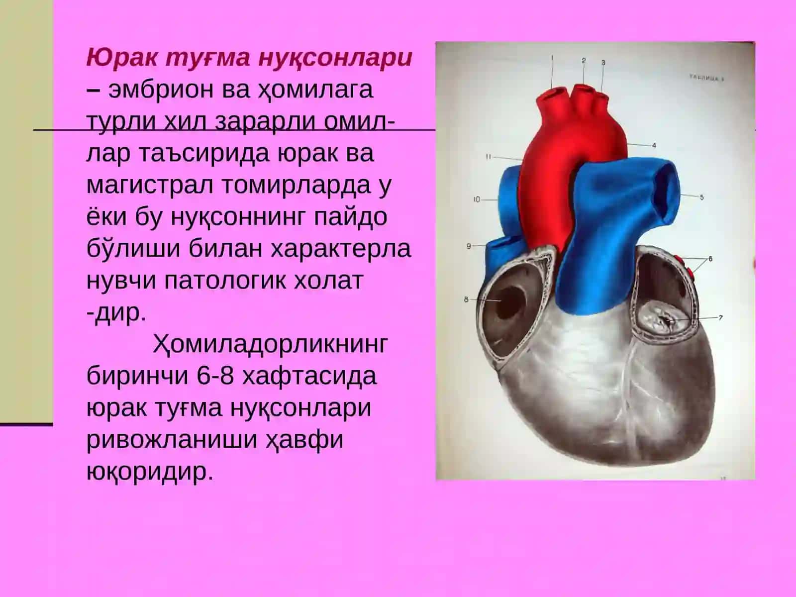 Юрак туғма нуқсонлари синдоми 2