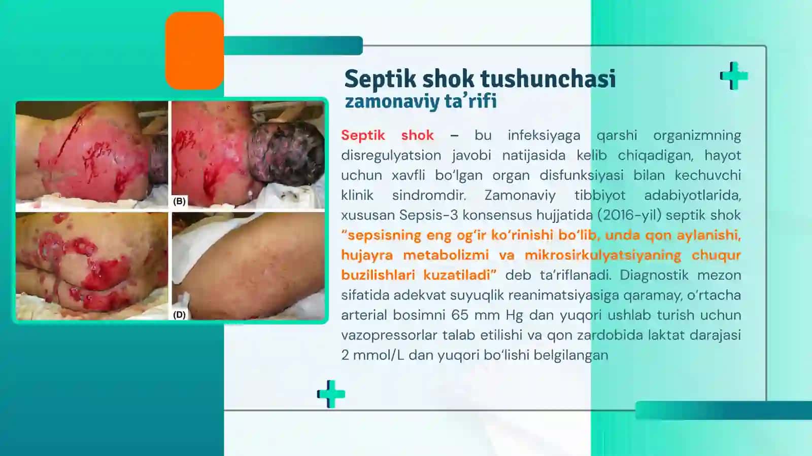 Septik shok 2
