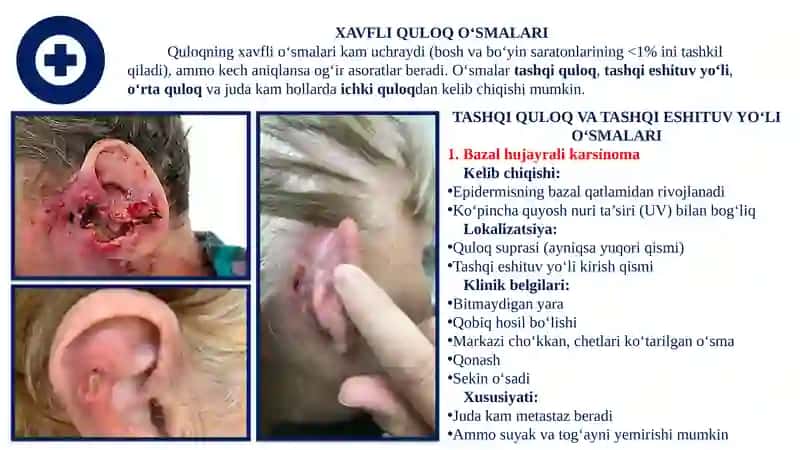 QULOQNING XAVFLI O‘SMALARI 2