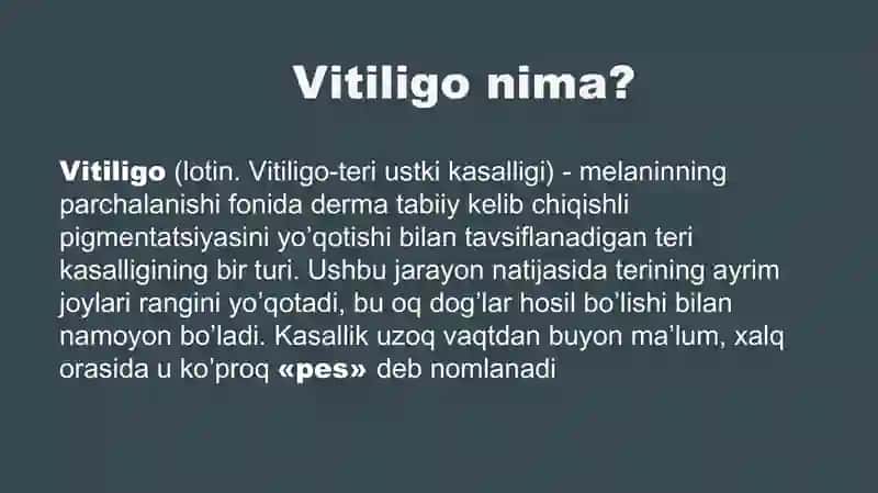 VITILIGO va  UNING ZAMONAVIY DAVOLASH USULLARI 2