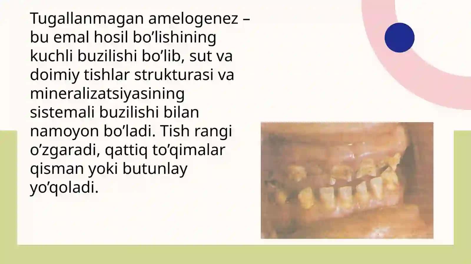 Tishqattiq to'qimasining nasliy kasalliklari 2