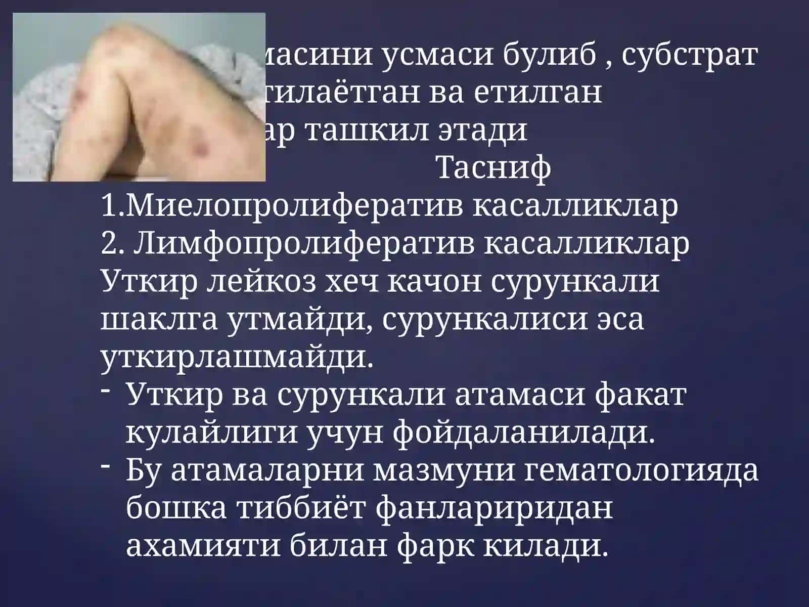 Сурункалилейкозлар 2