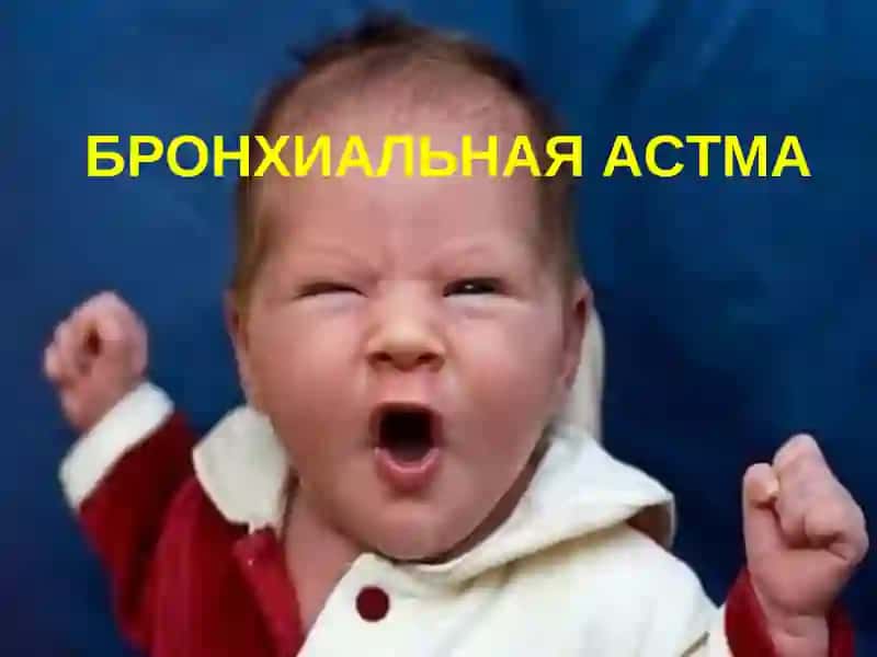БРОНХИАЛЬНАЯ АСТМА 2