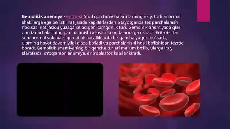 Gemolitik Anemiya 2