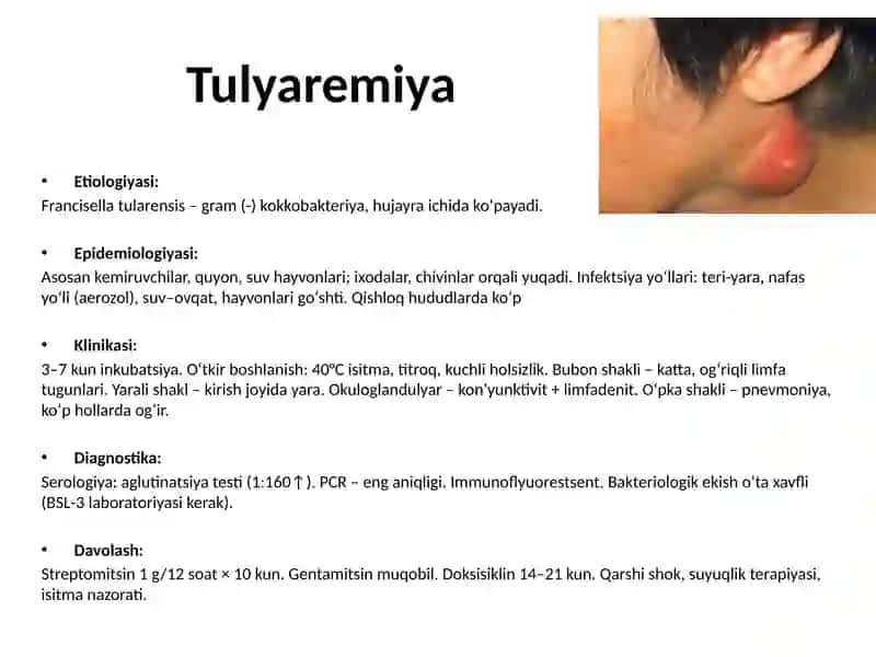 Tulyaremiya 2