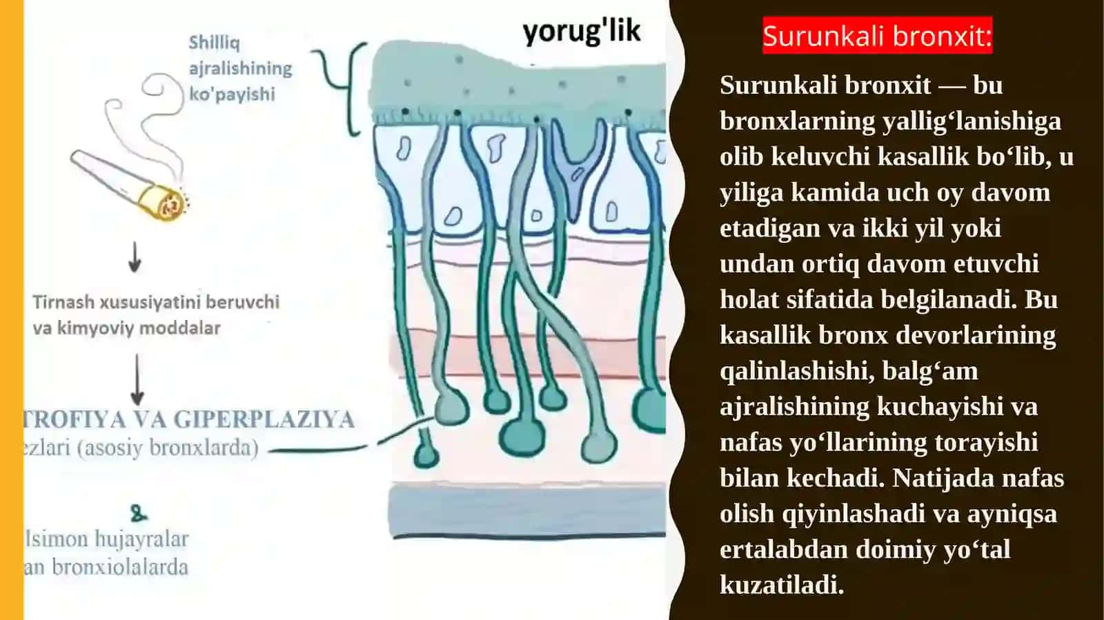 Surunkali bronxit 2