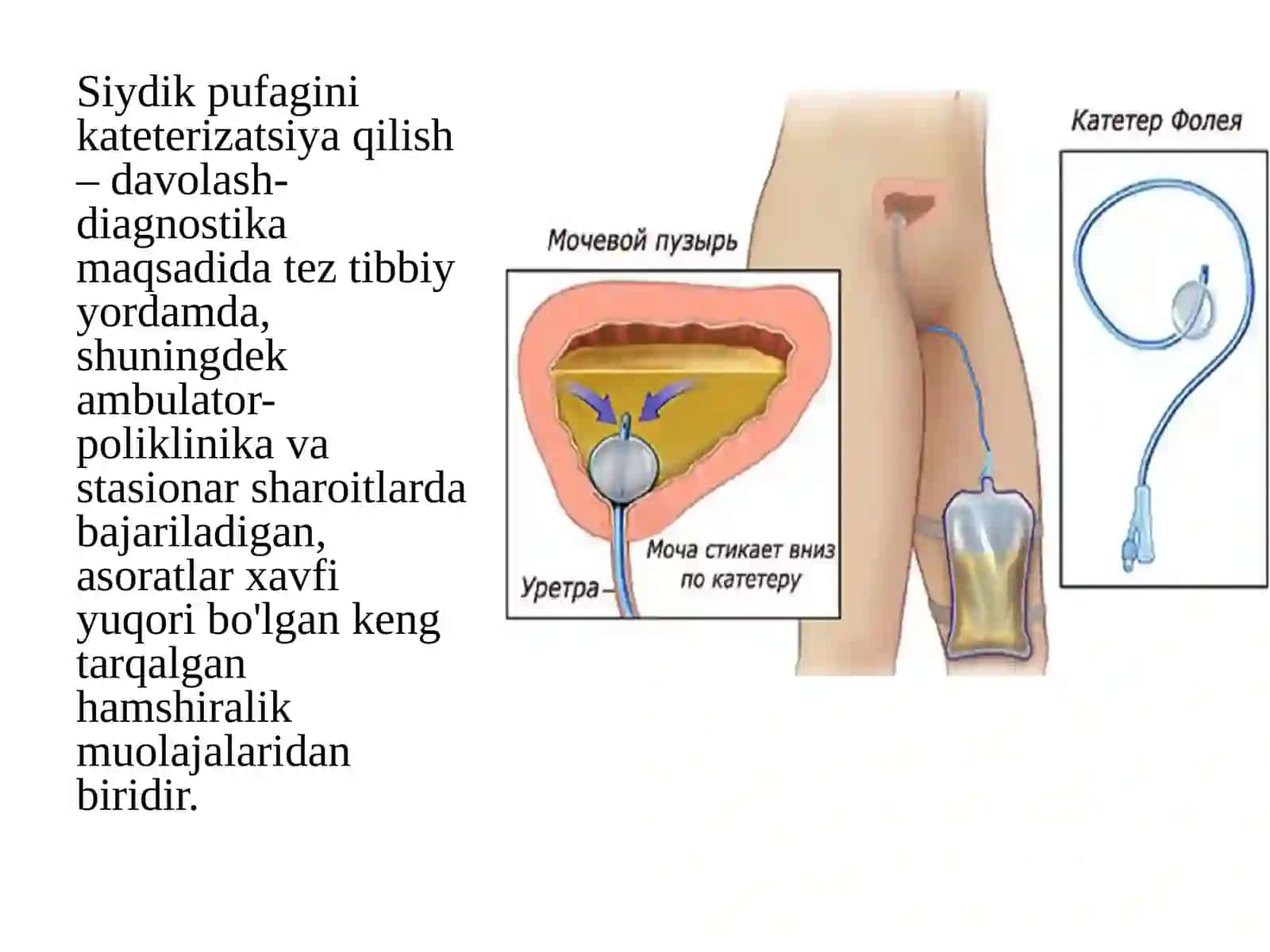 Qovuqni kateterizatsiya qilish texnikasi 2