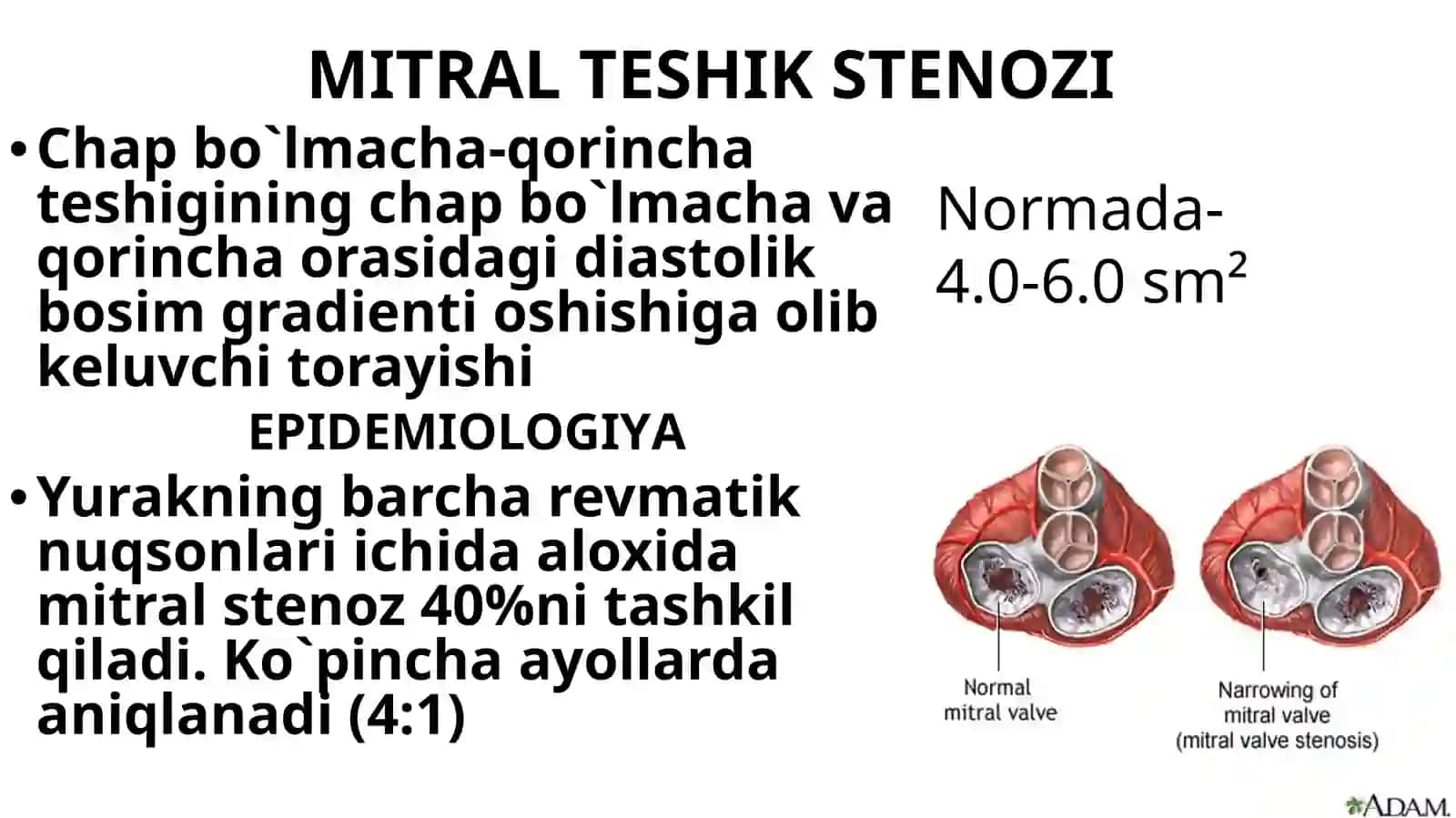 Mitral stenoz 2