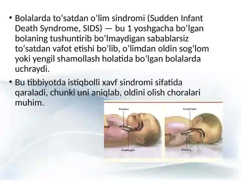 Bolalarda to‘satdan o‘lim 2
