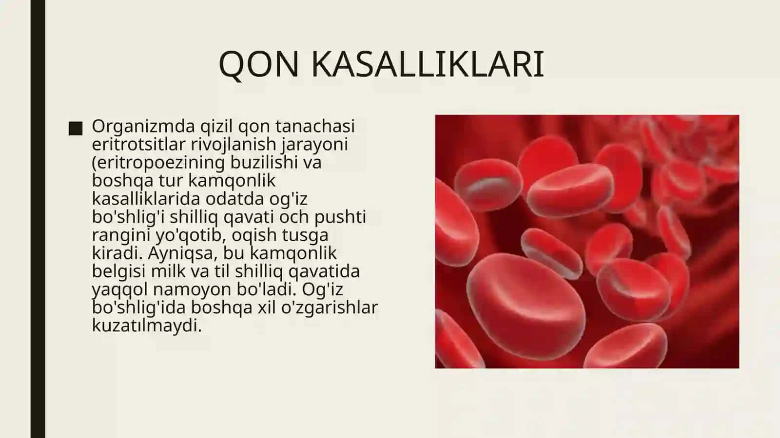 Qon kasalliklarida og'iz shilliq pardasidagi o'zgarishlar 2