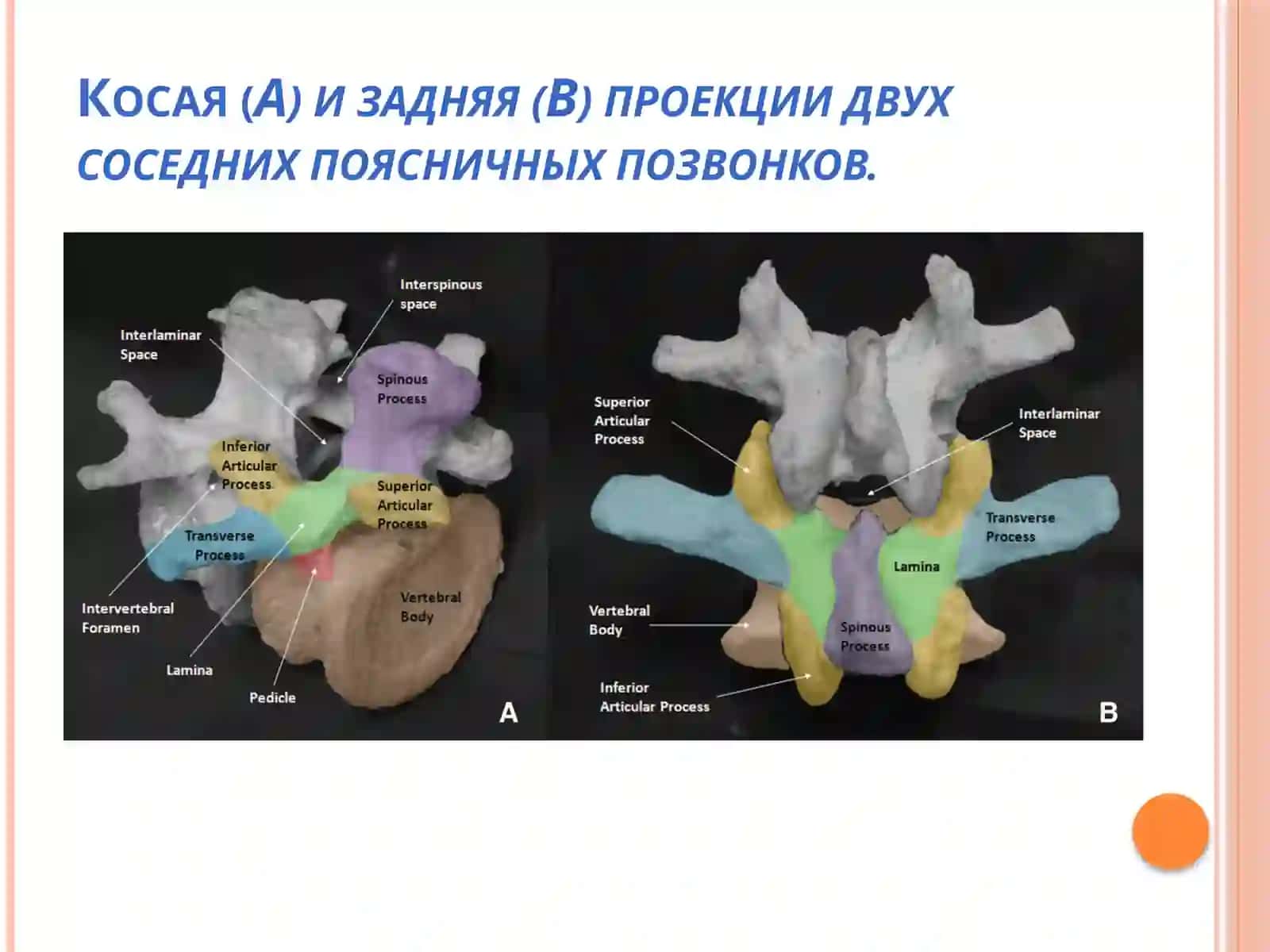 Ультразвуковая визуализация позвоночника 2
