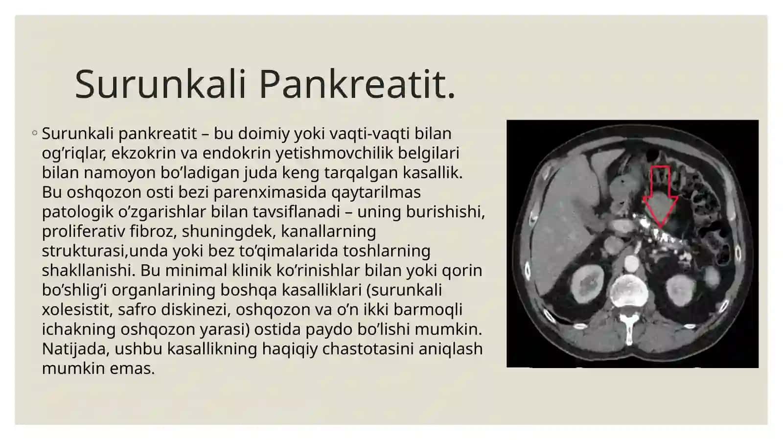 Surunkali Pankreatit 2