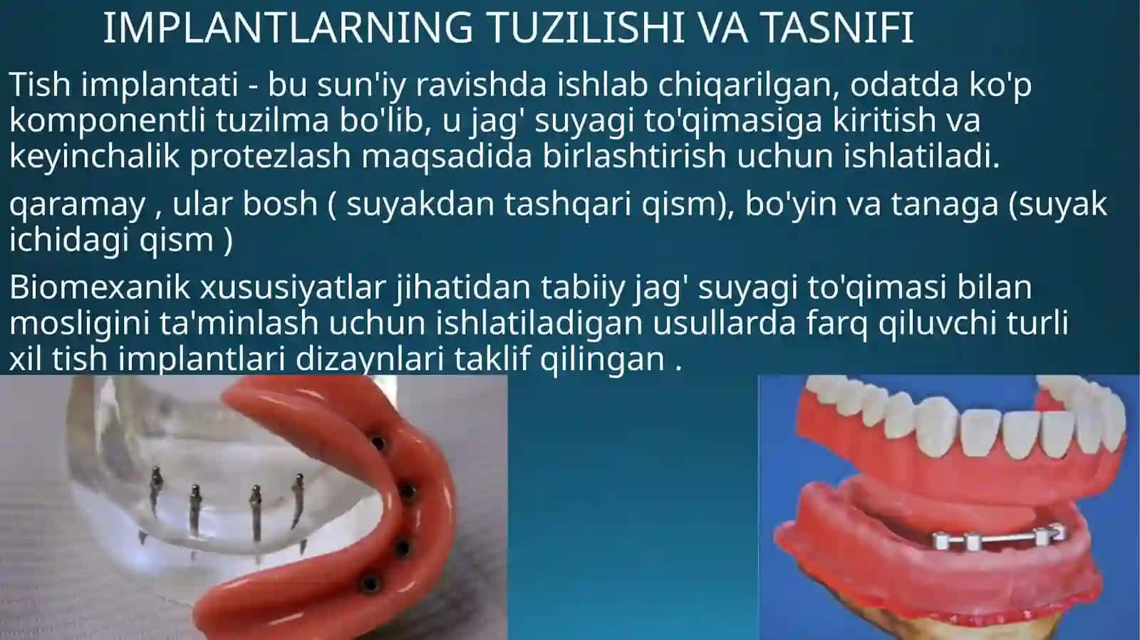 To'liq olib qo'yiladigan protezlarni implantlar bilan fiksatsiya qilish turlari 2