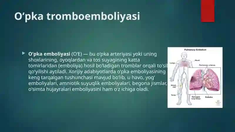 O’pka arteriyasi tromboemboliyasi 2