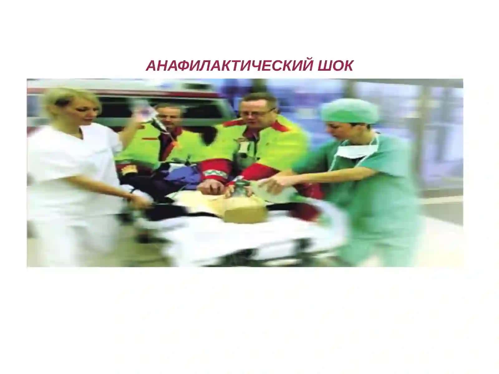 АНАФИЛАКТИЧЕСКИЙ ШОК 2