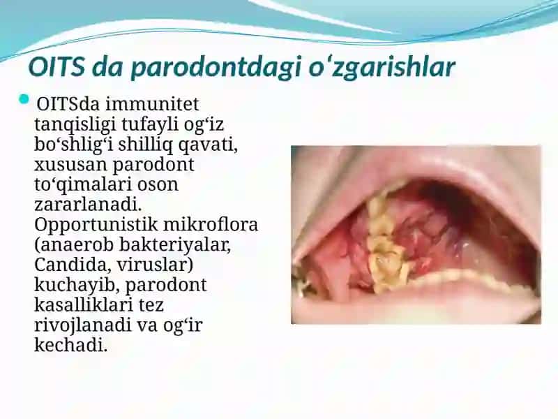 OITSdaparodontdagio‘zgarishlar 2