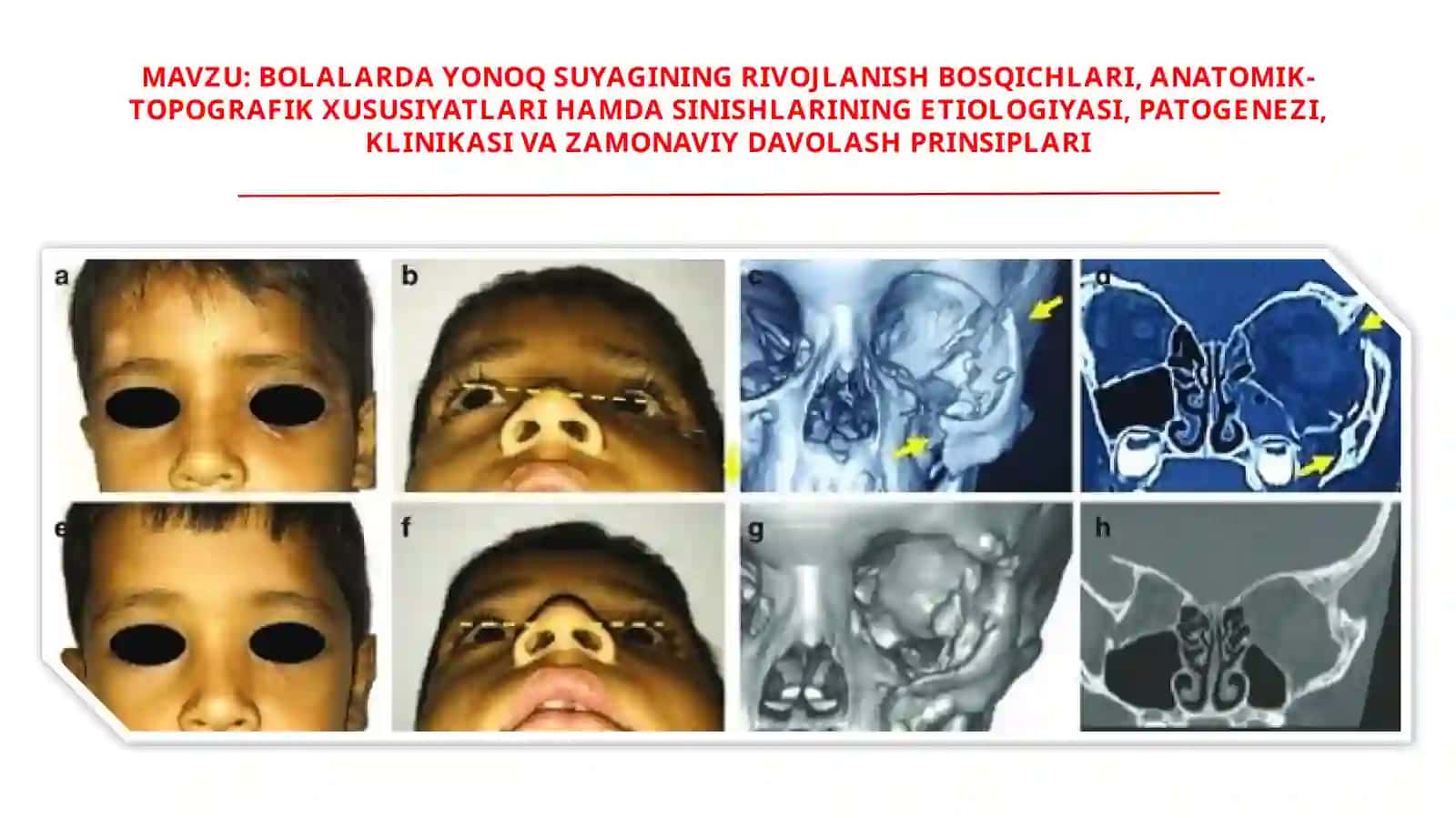 BOLALARDA YONOQ SUYAGINING RIVOJLANISH BOSQICHLARI 2