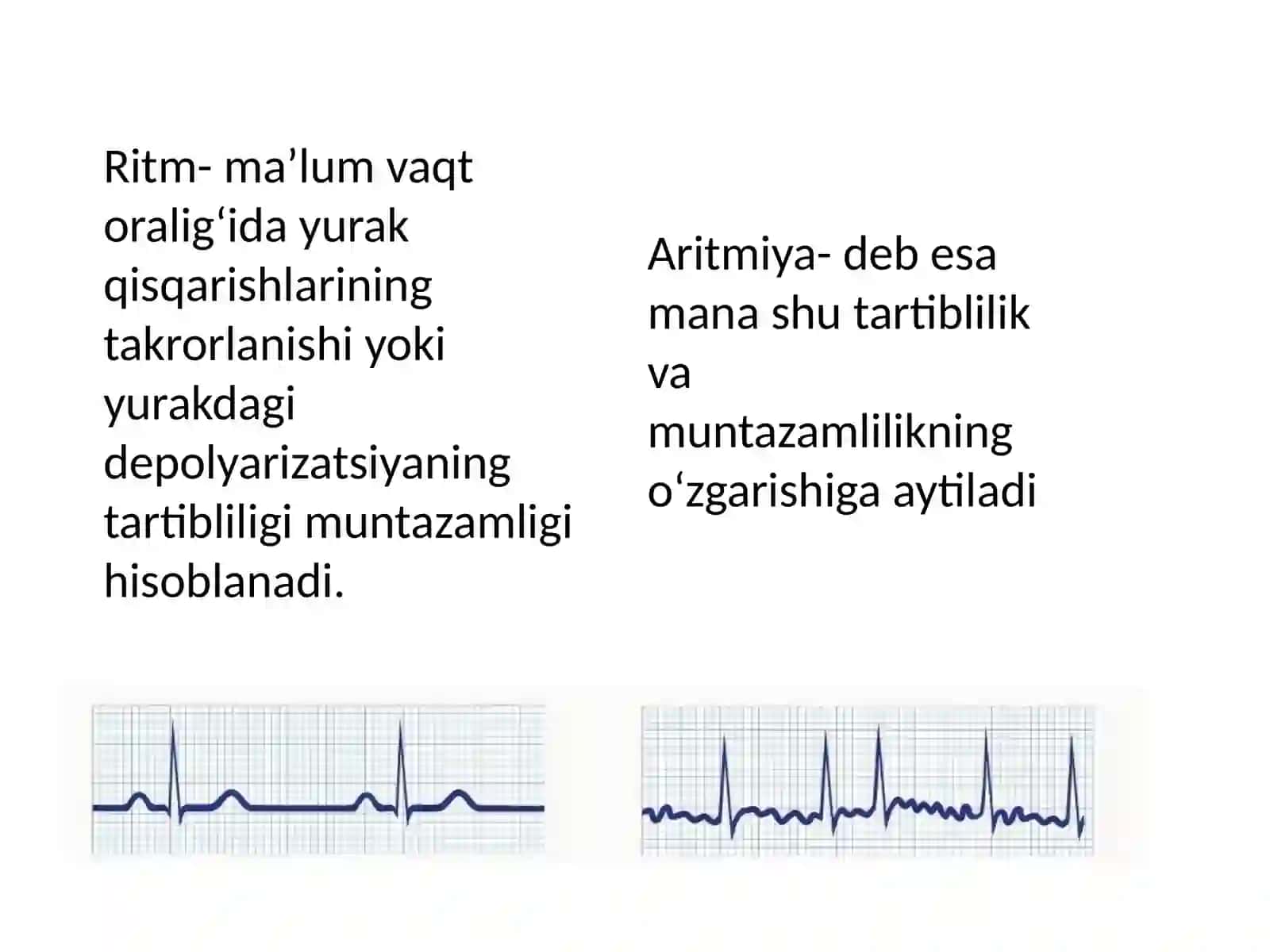 Yurak ritmi buzilishlari 2