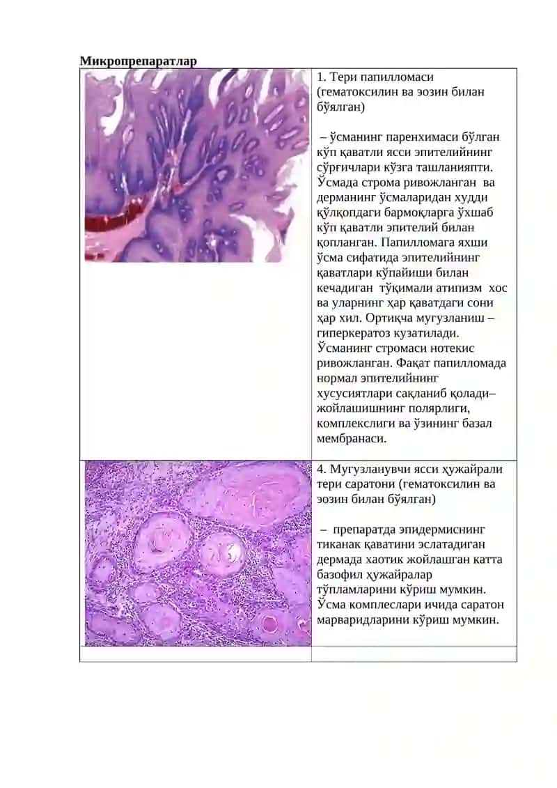 Тери папилломаси 2