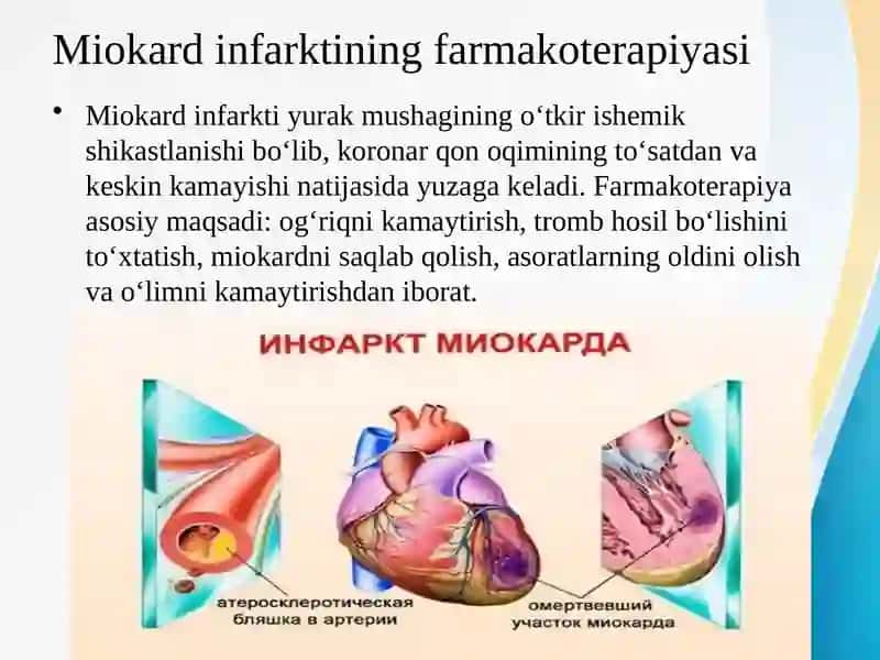 Miokard infarktining farmakoterapiyasi 2