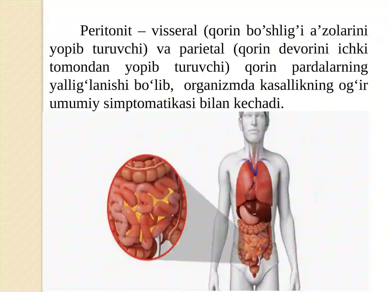 Peritonit. Birlamchi va ikkilamchi peritonitlar 2