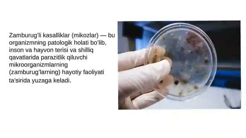 Zamburug‘li kasalliklar 2