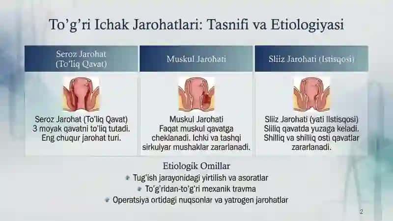 To'g'ri ichak va tashqi jinsiy a'zolar og'nalari, urug' yo'li,  moyak qavatlari istisqosi, epispadi 2