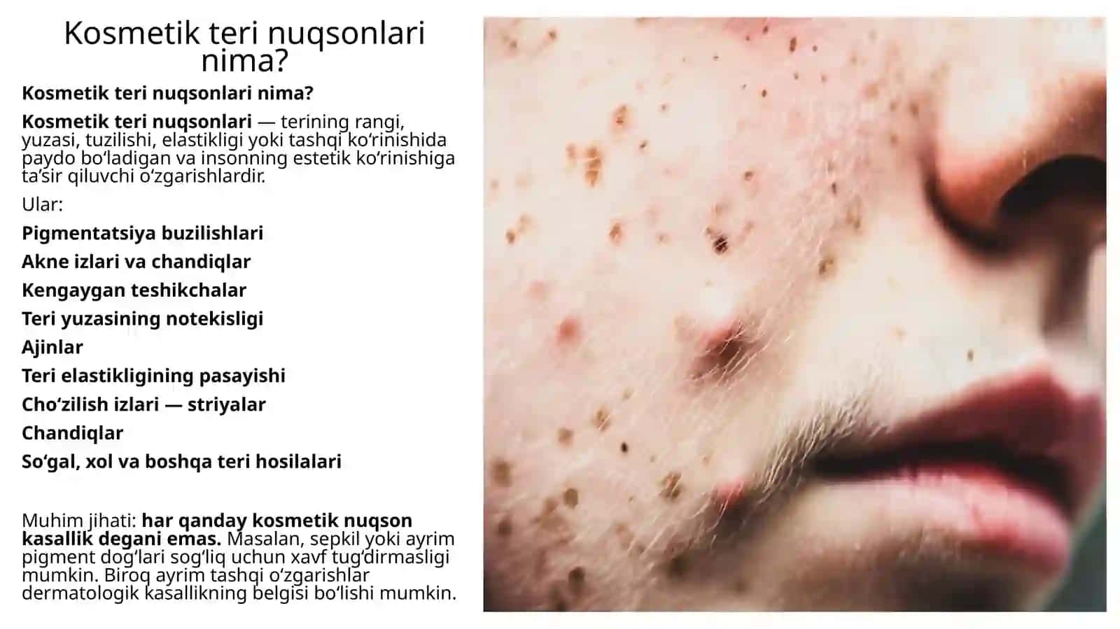 Kosmetik terining nuqsonlarini diagnostika qilish 2