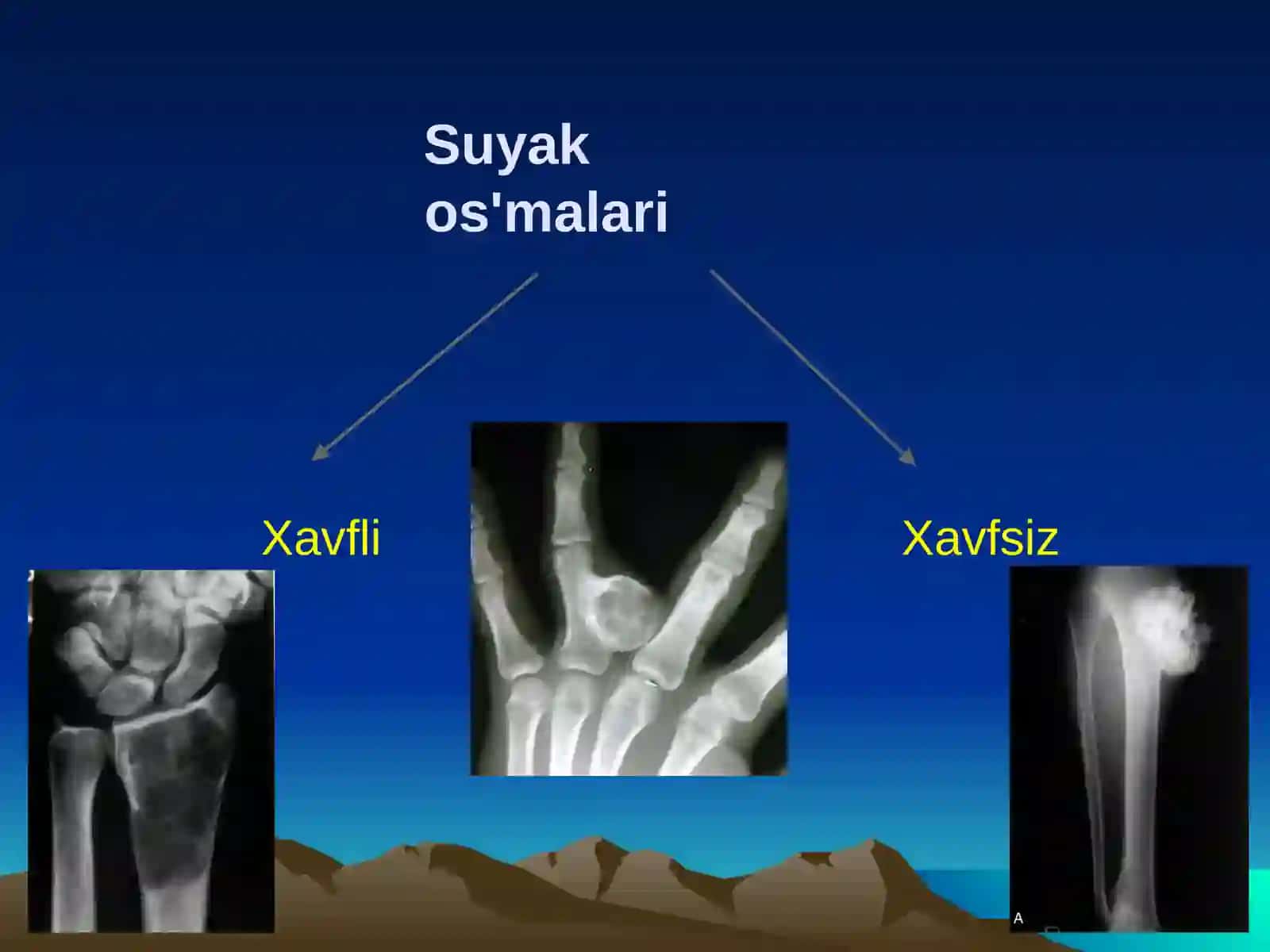 Suyako'smalarinurdiagnostikasi 2