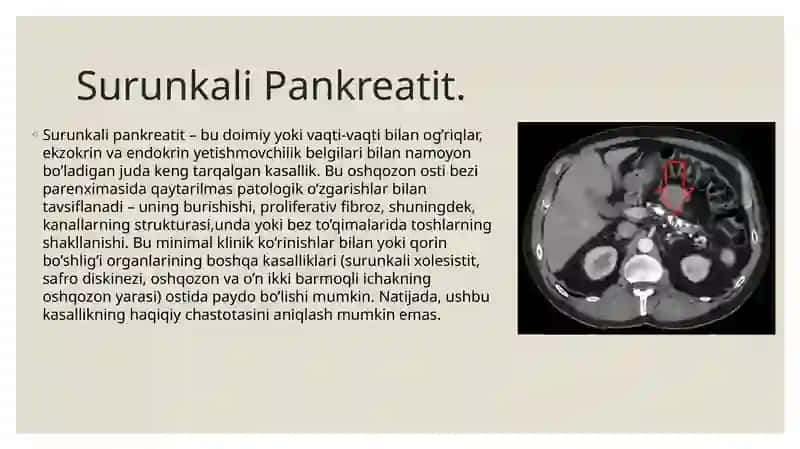 Surunkali Pankereatit 2