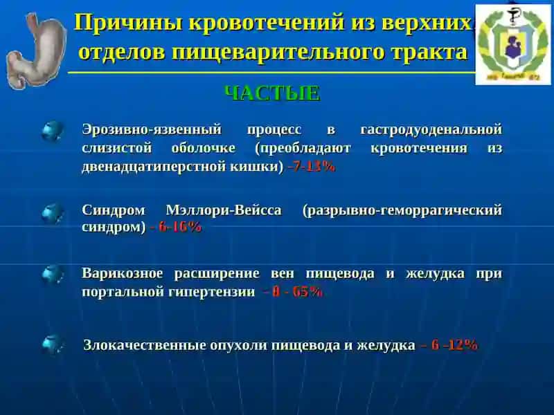 Острые желудочно-кишечные кровотечения 2
