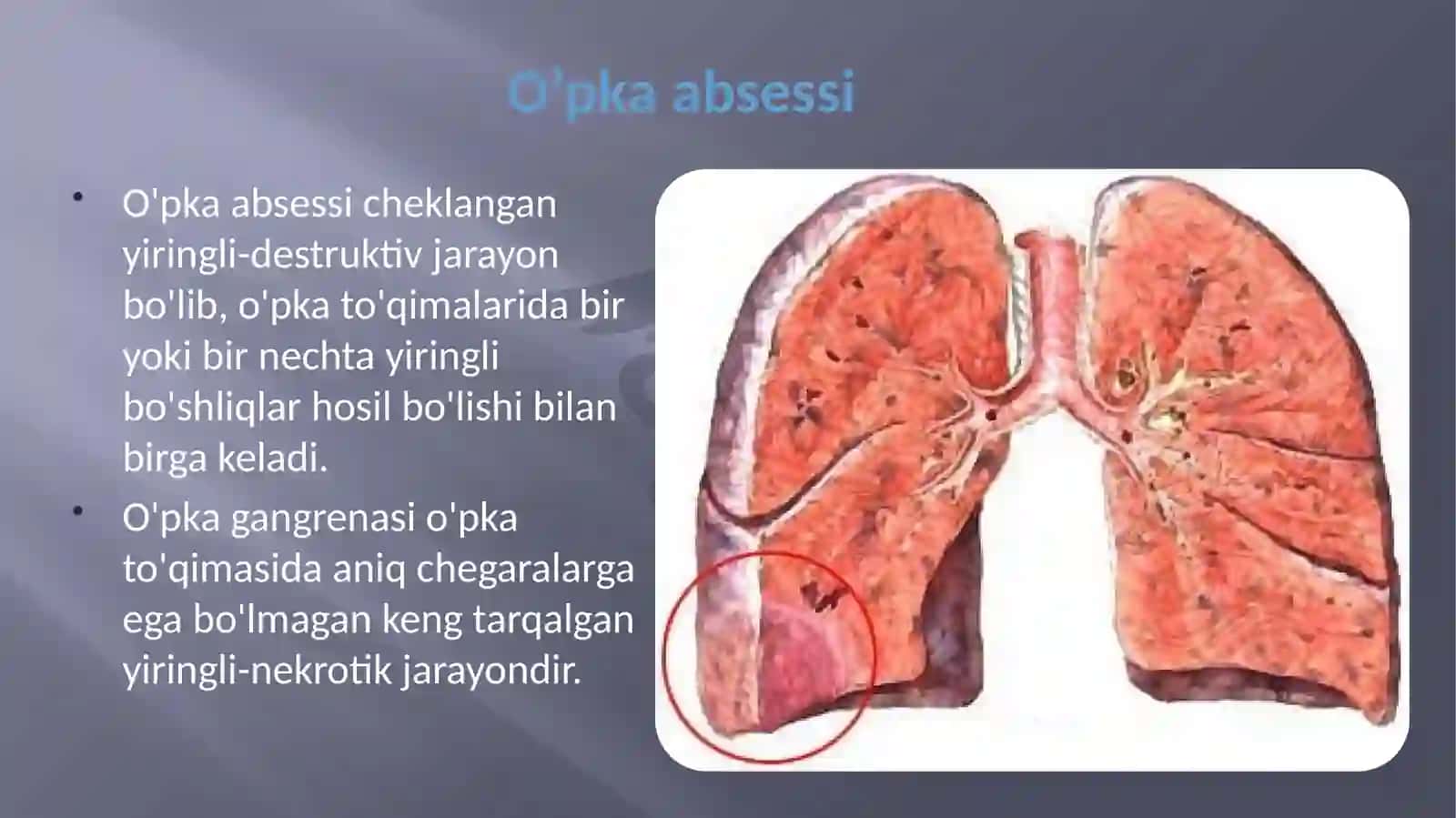 O’pka va plevraning xirurgik kasalliklari abssess va gangrenasi, plevritlar 2