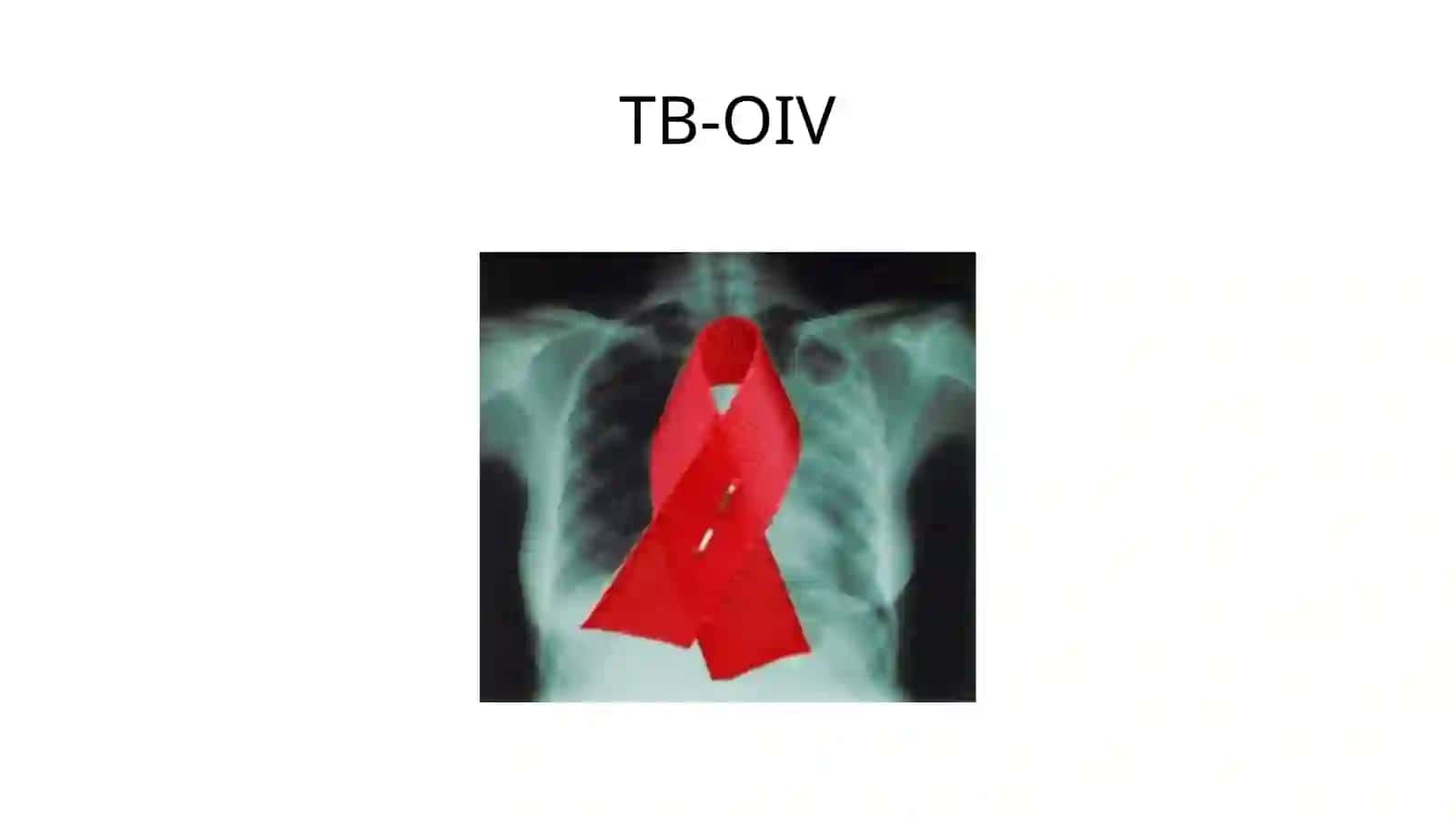 TB-OIV 2