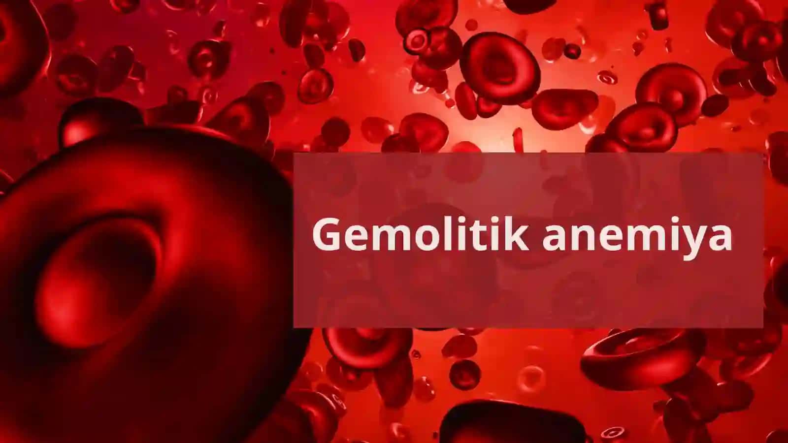Gemolitik anemiya 2