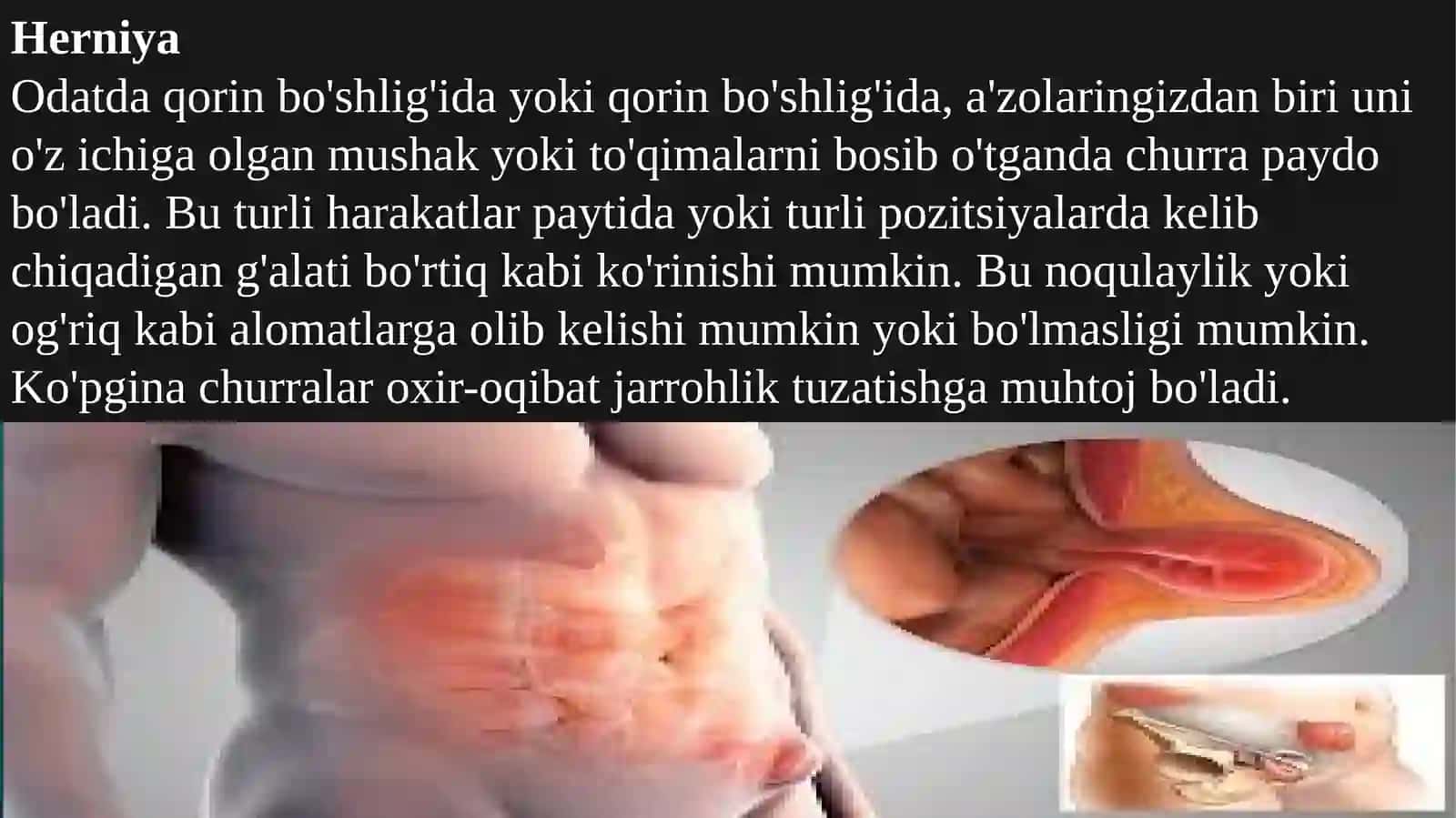 Herniya 2